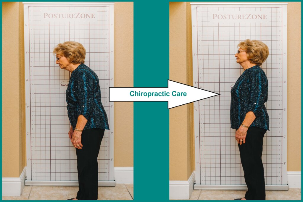 Chiropractic Care & Posture Improvement At Etheredge Chiropractic in Leesburg Fl